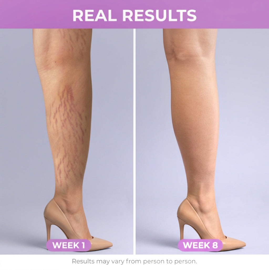 South Moon Stretch Mark Cream PRO