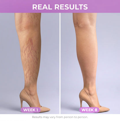 South Moon Stretch Mark Cream PRO